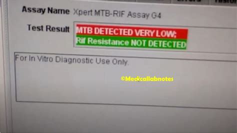 mtb not detected|Interpreting very low Mycobacterium tuberculosis detected on .